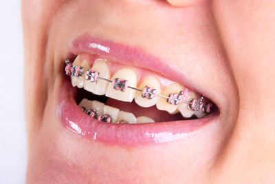 Alignment Dentistry